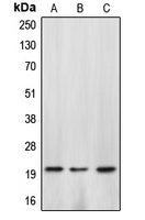 CASP4 / Caspase 4 Antibody - Western blot analysis of Caspase 4 p20 expression in HepG2 colchicine-treated (A); SP2/0 H2O2-treated (B); rat kidney (C) whole cell lysates.