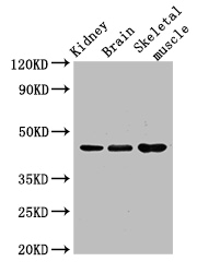 CASP4 / Caspase 4 Antibody - Positive WB detected in:Mouse kidney tissue,Mouse brain tissue,Mouse skeletal muscle tissue;All lanes:CASP4 antibody at 3.5ug/ml;Secondary;Goat polyclonal to rabbit IgG at 1/50000 dilution;Predicted band size: 44,37,14,31,19 kDa;Observed band size: 44 kDa;