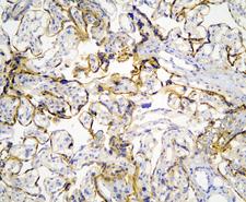 CASP4 / Caspase 4 Antibody - IHC analysis of Caspase 4 using anti-Caspase 4 antibody. Caspase 4 was detected in paraffin-embedded section of human placenta tissues. Heat mediated antigen retrieval was performed in citrate buffer (pH6, epitope retrieval solution) for 20 mins. The tissue section was blocked with 10% goat serum. The tissue section was then incubated with 1µg/ml rabbit anti-Caspase 4 Antibody overnight at 4°C. Biotinylated goat anti-rabbit IgG was used as secondary antibody and incubated for 30 minutes at 37°C. The tissue section was developed using Strepavidin-Biotin-Complex (SABC) with DAB as the chromogen.
