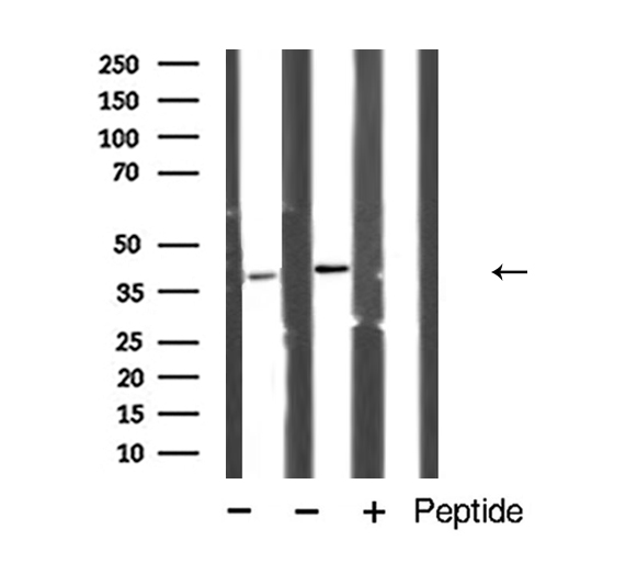 CASP4 / Caspase 4 Antibody - Western blot analysis of Caspase 4 expression in mouse brain and lung.