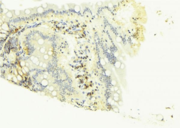 CASP4 / Caspase 4 Antibody - 1:100 staining mouse colon tissue by IHC-P. The sample was formaldehyde fixed and a heat mediated antigen retrieval step in citrate buffer was performed. The sample was then blocked and incubated with the antibody for 1.5 hours at 22°C. An HRP conjugated goat anti-rabbit antibody was used as the secondary.