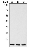 CASP5 / Caspase 5 Antibody - Western blot analysis of Caspase 5 p10 expression in Jurkat (A); mouse liver (B); rat liver (C) whole cell lysates.