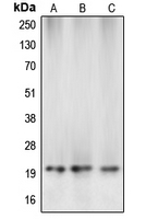CASP5 / Caspase 5 Antibody - Western blot analysis of Caspase 5 p20 expression in MCF7 (A); mouse kidney (B); rat liver (C) whole cell lysates.