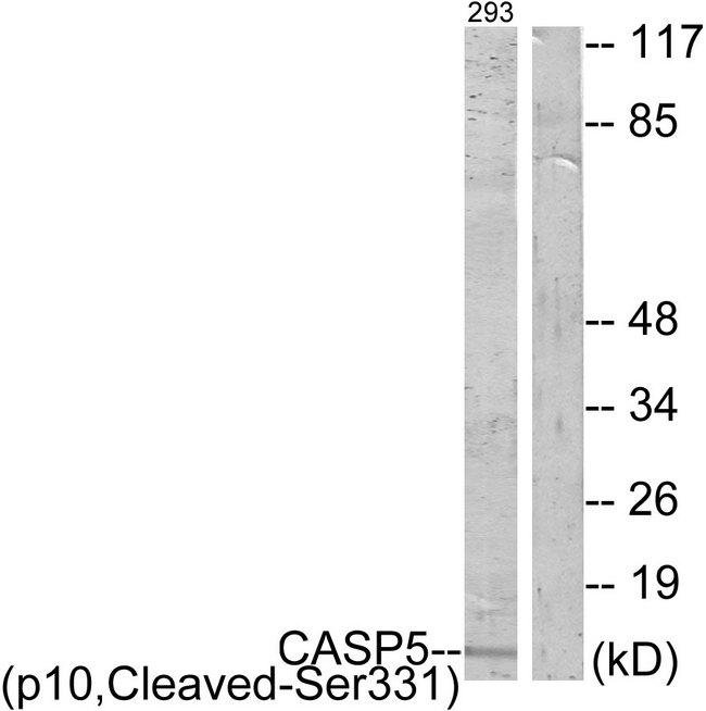 CASP5 / Caspase 5 Antibody - Western blot analysis of extracts from 293 cells, treated with etoposide (25uM, 1hour), using CASP5 (p10, Cleaved-Ser331) antibody.