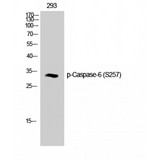 CASP6 / Caspase 6 Antibody - Western blot of Phospho-Caspase-6 (S257) antibody