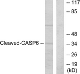CASP6 / Caspase 6 Antibody - Western blot of extracts from HeLa cells, treated with Etoposide 25 uM 60', using Caspase 6 (Cleaved-Asp162) Antibody. The lane on the right is treated with the synthesized peptide.