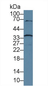 CASP6 / Caspase 6 Antibody - Western Blot; Sample: Human Jurkat cell lysate; Primary Ab: 3µg/ml Rabbit Anti-Human CASP6 Antibody Second Ab: 0.2µg/mL HRP-Linked Caprine Anti-Rabbit IgG Polyclonal Antibody