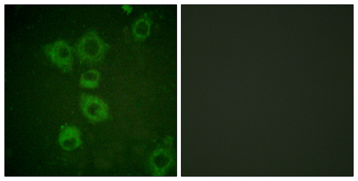 CASP6 / Caspase 6 Antibody - Immunofluorescence analysis of HUVEC cells, using Caspase 6 Antibody. The picture on the right is blocked with the synthesized peptide.