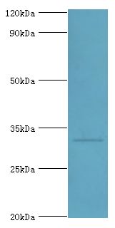 CASP6 / Caspase 6 Antibody - Western blot. All lanes: Caspase-6 antibody at 8 ug/ml+HeLa whole cell lysate. Secondary antibody: Goat polyclonal to rabbit at 1:10000 dilution. Predicted band size: 33 kDa. Observed band size: 33 kDa Immunohistochemistry.