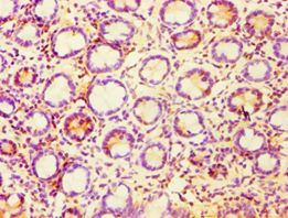 CASP6 / Caspase 6 Antibody - Immunohistochemistry of paraffin-embedded human small intestine tissue using antibody at 1:100 dilution.