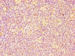 CASP6 / Caspase 6 Antibody - Immunohistochemistry of paraffin-embedded human tonsil tissue using antibody at 1:100 dilution.