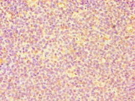 CASP6 / Caspase 6 Antibody - Immunohistochemistry of paraffin-embedded human tonsil tissue using CASP6 Antibody at dilution of 1:100