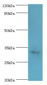CASP6 / Caspase 6 Antibody - Western blot. All lanes: Caspase-6 antibody at 3 ug/ml+mouse liver tissue. Secondary antibody: Goat polyclonal to rabbit at 1:10000 dilution. Predicted band size: 33 kDa. Observed band size: 33 kDa Immunohistochemistry.