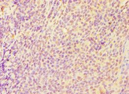 CASP6 / Caspase 6 Antibody - Immunohistochemistry of paraffin-embedded human tonsil tissue tissue using antibody at 1:100 dilution.