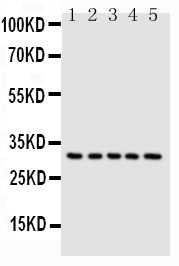 CASP6 / Caspase 6 Antibody - Anti-Caspase-6(P18) antibody, Western blotting Lane 1: MCF-7 Cell LysateLane 2: HELA Cell LysateLane 3: JURKAT Cell LysateLane 4: CEM Cell LysateLane 5: SW620 Cell Lysate