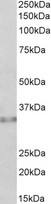 CASP6 / Caspase 6 Antibody - CASP6 antibody (0.5 ug/ml) staining of Human Colon lysate (35 ug protein in RIPA buffer). Primary incubation was 1 hour. Detected by chemiluminescence.