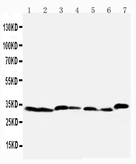 CASP6 / Caspase 6 Antibody - Caspase-6(P18) antibody Western blot. Lane 1: Rat Liver Tissue Lysate. Lane 2: Rat Kidney Tissue Lysate. Lane 3: Rat Testis Tissue Lysate. Lane 4: NRK Cell Lysate. Lane 5: Mouse Liver Tissue Lysate. Lane 6: Mouse Kidney Tissue Lysate. Lane 7: Mouse Testis Tissue Lysate.