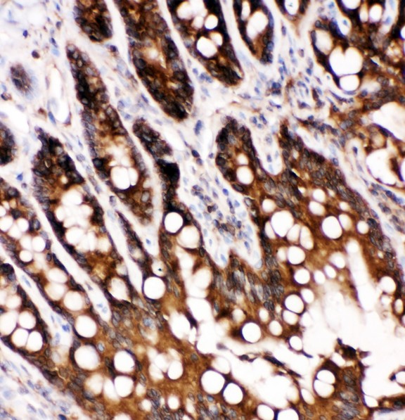 CASP6 / Caspase 6 Antibody - Caspase-6(P18) antibody IHC-paraffin: Rat Intestine Tissue.