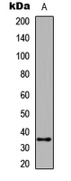 CASP6 / Caspase 6 Antibody - Western blot analysis of Caspase 6 expression in HepG2 (A); Raw264.7 (B) whole cell lysates.