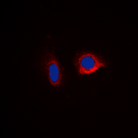 CASP6 / Caspase 6 Antibody - Immunofluorescent analysis of Caspase 6 staining in HepG2 cells. Formalin-fixed cells were permeabilized with 0.1% Triton X-100 in TBS for 5-10 minutes and blocked with 3% BSA-PBS for 30 minutes at room temperature. Cells were probed with the primary antibody in 3% BSA-PBS and incubated overnight at 4 deg C in a humidified chamber. Cells were washed with PBST and incubated with a DyLight 594-conjugated secondary antibody (red) in PBS at room temperature in the dark. DAPI was used to stain the cell nuclei (blue).