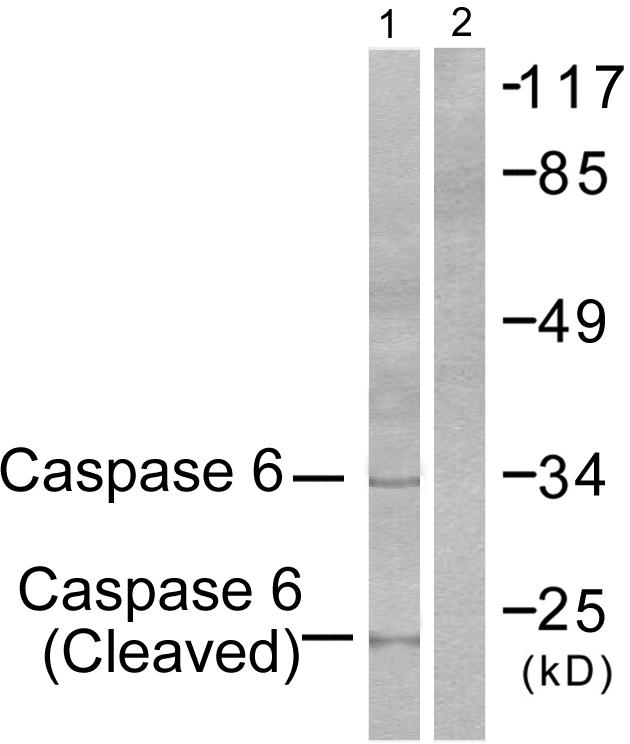CASP6 / Caspase 6 Antibody - Western blot analysis of extracts from HeLa cells, treated with etoposide (25µM, 1hour), using Caspase 6 (cleaved-Asp162) antibody.