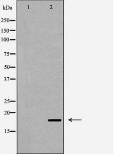 CASP6 / Caspase 6 Antibody - Western blot analysis of Caspase 6 (Cleaved-Asp179) expression in HeLa cells. The lane on the left is treated with the antigen-specific peptide.