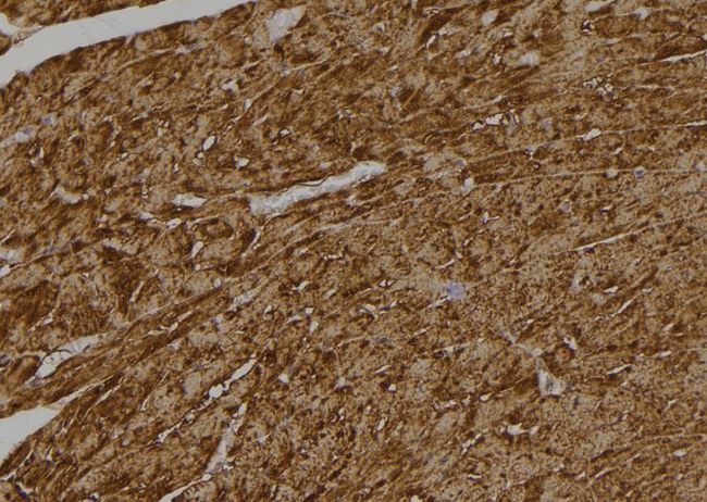 CASP6 / Caspase 6 Antibody - 1:100 staining rat heart tissue by IHC-P. The sample was formaldehyde fixed and a heat mediated antigen retrieval step in citrate buffer was performed. The sample was then blocked and incubated with the antibody for 1.5 hours at 22°C. An HRP conjugated goat anti-rabbit antibody was used as the secondary.