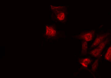CASP6 / Caspase 6 Antibody - Staining 293 cells by IF/ICC. The samples were fixed with PFA and permeabilized in 0.1% Triton X-100, then blocked in 10% serum for 45 min at 25°C. The primary antibody was diluted at 1:200 and incubated with the sample for 1 hour at 37°C. An Alexa Fluor 594 conjugated goat anti-rabbit IgG (H+L) Ab, diluted at 1/600, was used as the secondary antibody.