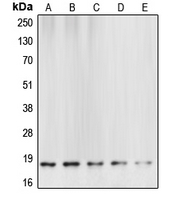 CASP6 / Caspase 6 Antibody - Western blot analysis of Caspase 6 p18 expression in HeLa (A); mouse brain (B); rat kidney (C); NIH3T3 staurosporine-treated (D); Jurkat etoposide-treated (E) whole cell lysates.
