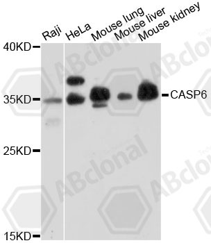 CASP6 / Caspase 6 Antibody - Western blot analysis of extracts of various cell lines.