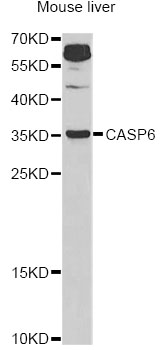 CASP6 / Caspase 6 Antibody - Western blot analysis of extracts of mouse liver, using CASP6 antibody at 1:1000 dilution. The secondary antibody used was an HRP Goat Anti-Rabbit IgG (H+L) at 1:10000 dilution. Lysates were loaded 25ug per lane and 3% nonfat dry milk in TBST was used for blocking. An ECL Kit was used for detection.