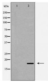 CASP6 / Caspase 6 Antibody - Western blot of Caspase 6 (Cleaved-Asp179) expression in HeLa cells