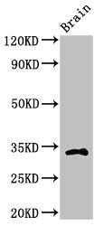 CASP6 / Caspase 6 Antibody - Western Blot Positive WB detected in:Mouse brain tissue All Lanes:CASP6 antibody at 2.4µg/ml Secondary Goat polyclonal to rabbit IgG at 1/50000 dilution Predicted band size: 34,23 KDa Observed band size: 34 KDa