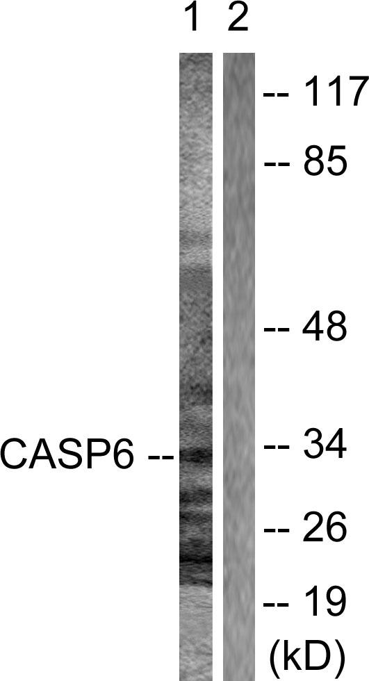 CASP6 / Caspase 6 Antibody - Western blot analysis of extracts from A431 cells, using Caspase 6 (Ab-257) antibody.