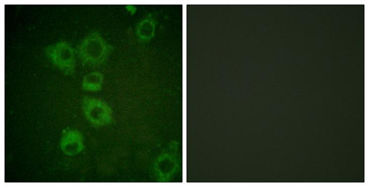CASP6 / Caspase 6 Antibody - Peptide - + Immunofluorescence analysis of HuvEc cells, using Caspase 6 (Ab-257) antibody.