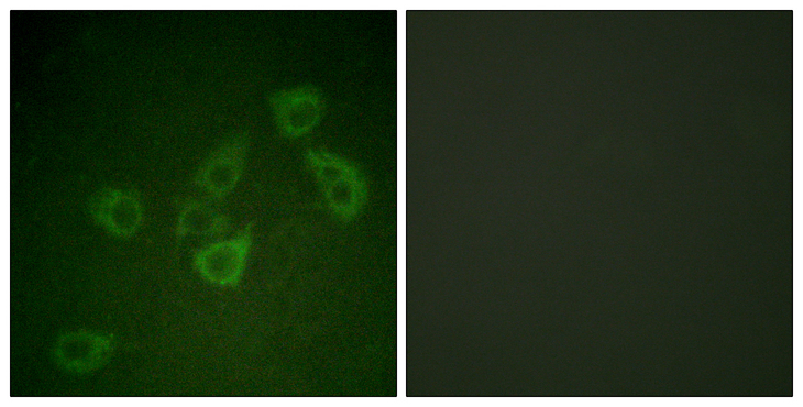 CASP6 / Caspase 6 Antibody - Immunofluorescence analysis of HUVEC cells, using Caspase 6 (Phospho-Ser257) Antibody. The picture on the right is blocked with the phospho peptide.