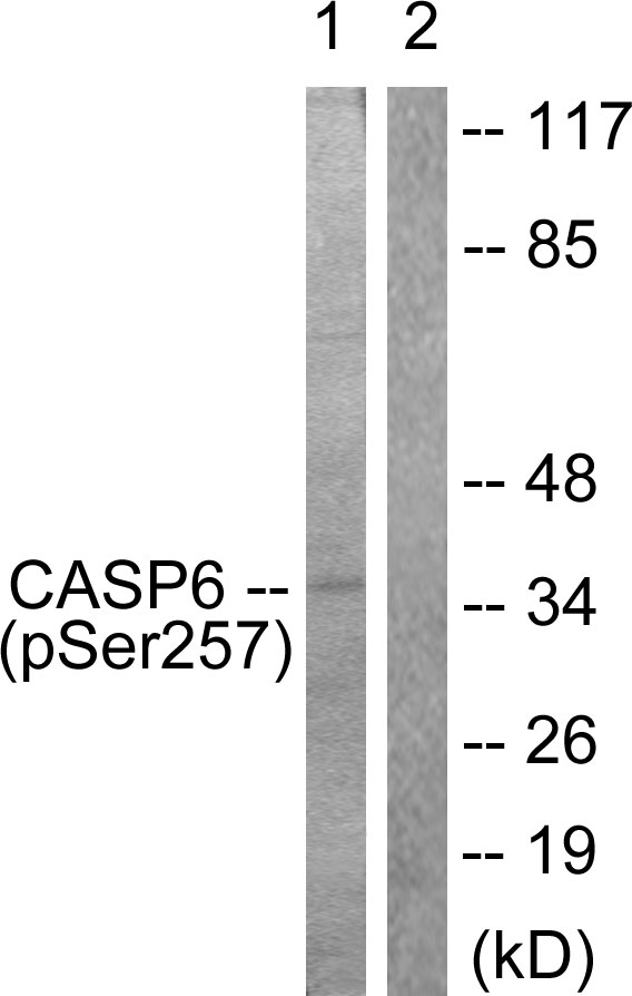 CASP6 / Caspase 6 Antibody - Western blot analysis of lysates from 293 cells treated with Etoposide 25uM 60', using Caspase 6 (Phospho-Ser257) Antibody. The lane on the right is blocked with the phospho peptide.