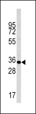 CASP6 / Caspase 6 Antibody - Western blot of anti-Phospho-Caspase-pS257 in liver cell line lysates (35 ug/lane). Casp6-pS257(arrow) was detected using the purified antibody.