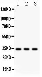 CASP7 / Caspase 7 Antibody - Caspase-7 antibody Western blot. All lanes: Anti Caspase-7 at 0.5 ug/ml. Lane 1: A549 Whole Cell Lysate at 40 ug. Lane 2: Rat Spleen Tissue Lysate at 50 ug. Lane 3: Rat Lung Tissue Lysate at 50 ug. Predicted band size: 34 kD. Observed band size: 34 kD.