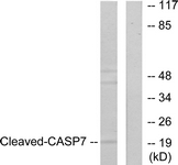 CASP7 / Caspase 7 Antibody - Western blot of extracts from 293 cells, treated with Etoposide 25 uM 60', using Caspase 7 (Cleaved-Asp198) Antibody. The lane on the right is treated with the synthesized peptide.