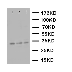 CASP7 / Caspase 7 Antibody - WB of CASP7 / Caspase 7 antibody. Lane 1: HELA Cell Lysate. Lane 2: MCF-7 Cell Lysate. Lane 3: SMMC Cell Lysate.