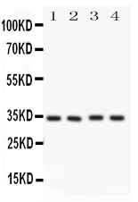 CASP7 / Caspase 7 Antibody - Anti-Caspase-7(P11) antibody, Western blotting All lanes: Anti CASP7(p11) at 0.5ug/ml Lane 1: HELA Whole Cell Lysate at 40ugLane 2: MCF-7 Whole Cell Lysate at 40ugLane 3: Rat Liver Tissue Lysate at 50ugLane 4: Rat Kidney Tissue Lysate at 50ugPredicted bind size: 34KD Observed bind size: 34KD