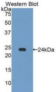 CASP7 / Caspase 7 Antibody - Western blot of recombinant CASP7 / Caspase 7.  This image was taken for the unconjugated form of this product. Other forms have not been tested.