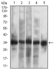 CASP7 / Caspase 7 Antibody - Western blot analysis using CASP-7 mouse mAb against Jurkat (1), HEK293 (2), MOLT4 (3), MCF-7 (4), PC-12 (5) cell lysate.