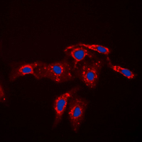CASP7 / Caspase 7 Antibody - Immunofluorescent analysis of Caspase 7 p11 staining in HEK293T cells. Formalin-fixed cells were permeabilized with 0.1% Triton X-100 in TBS for 5-10 minutes and blocked with 3% BSA-PBS for 30 minutes at room temperature. Cells were probed with the primary antibody in 3% BSA-PBS and incubated overnight at 4 C in a humidified chamber. Cells were washed with PBST and incubated with a DyLight 594-conjugated secondary antibody (red) in PBS at room temperature in the dark. DAPI was used to stain the cell nuclei (blue).