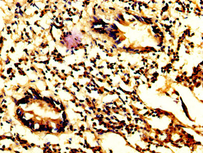 CASP7 / Caspase 7 Antibody - IHC image of CASP7 Antibody diluted at 1:200 and staining in paraffin-embedded human appendix tissue performed on a Leica BondTM system. After dewaxing and hydration, antigen retrieval was mediated by high pressure in a citrate buffer (pH 6.0). Section was blocked with 10% normal goat serum 30min at RT. Then primary antibody (1% BSA) was incubated at 4°C overnight. The primary is detected by a biotinylated secondary antibody and visualized using an HRP conjugated SP system.