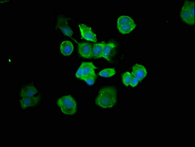 CASP7 / Caspase 7 Antibody - Immunofluorescence staining of MCF-7 cells with CASP7 Antibody at 1:66, counter-stained with DAPI. The cells were fixed in 4% formaldehyde, permeabilized using 0.2% Triton X-100 and blocked in 10% normal Goat Serum. The cells were then incubated with the antibody overnight at 4°C. The secondary antibody was Alexa Fluor 488-congugated AffiniPure Goat Anti-Rabbit IgG(H+L).