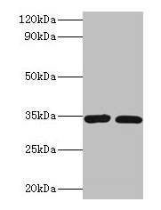 CASP7 / Caspase 7 Antibody - Western blot All lanes: Caspase-7 antibody at 2µg/ml Lane 1: A549 whole cell lysate Lane 2: HGC-27 whole cell lysate Secondary Goat polyclonal to rabbit IgG at 1/10000 dilution Predicted band size: 35, 29, 38, 32 kDa Observed band size: 35 kDa