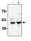 CASP7 / Caspase 7 Antibody - Western blot of caspase-7 antibody on MCF-7 cells treated with thapsigargin for 48 hours which are negative (-) and positive (+) for caspase-3.