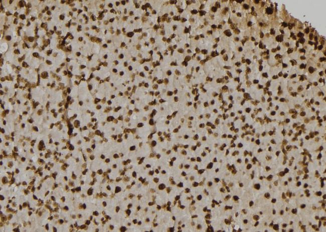 CASP7 / Caspase 7 Antibody - 1:100 staining rat liver tissue by IHC-P. The sample was formaldehyde fixed and a heat mediated antigen retrieval step in citrate buffer was performed. The sample was then blocked and incubated with the antibody for 1.5 hours at 22°C. An HRP conjugated goat anti-rabbit antibody was used as the secondary.